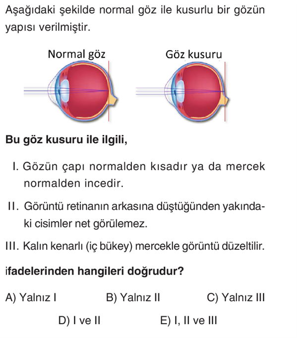 OGM Materyal